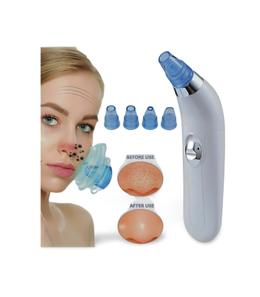 4 in 1 Derma Suction Device in Pakistan