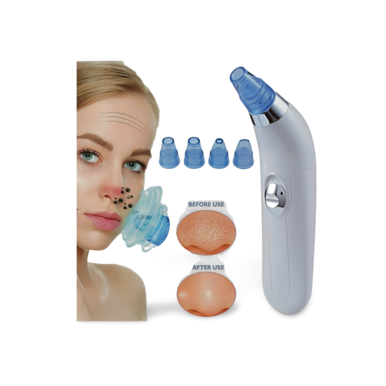 4 in 1 Derma Suction Device in Pakistan